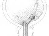 bobrek-tasi-kumu-3